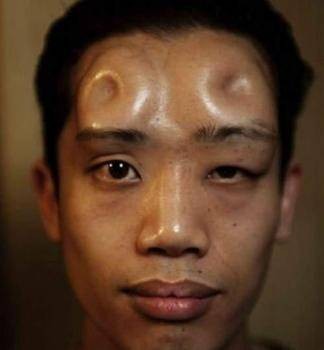 贝果头