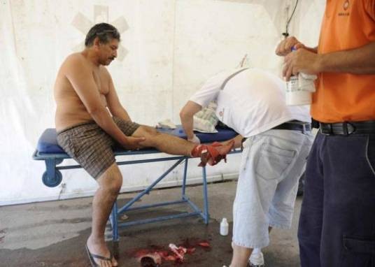 阿根廷食人鱼咬伤人事件