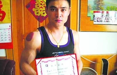 孙旭光(前全国体操冠军)