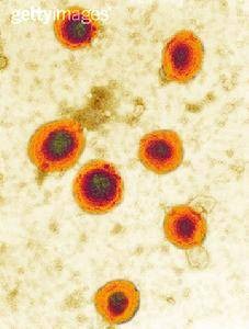 慢性化脓性腮腺炎