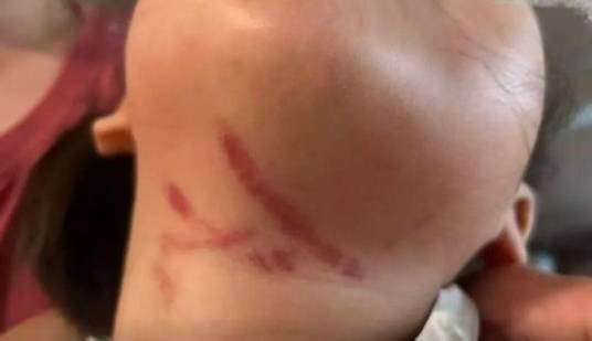 6·17中山女童被男老师暴力喂食事件