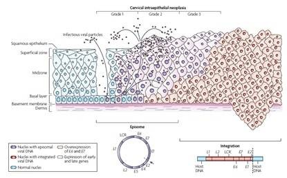 HPV E6/E7