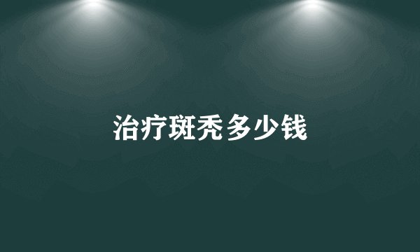 治疗斑秃多少钱