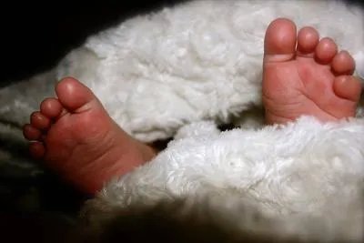 婴幼儿缺钙的表现及其症状
