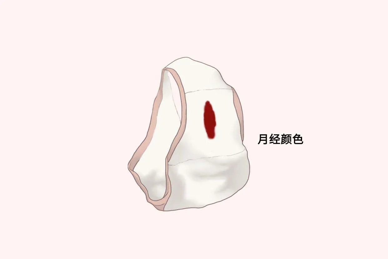 正常月经血图片
