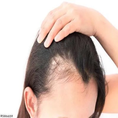 如何增加发际线