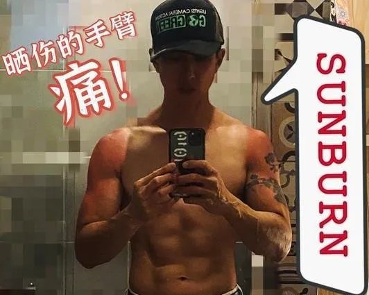 吴尊晒晒伤后的照片,这是在秀肌肉吗?