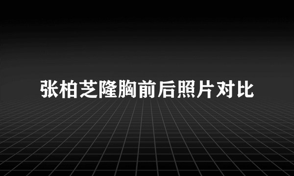 张柏芝隆胸前后照片对比