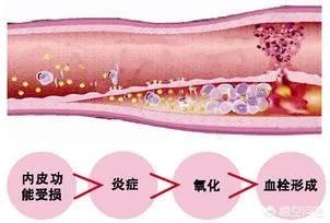 血管堵塞,身体会发出哪些求救信号?吃什么食物可以疏通血管?