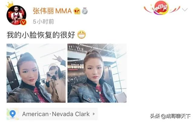 UFC冠军赛后,乔安娜需要进行整形手术而张伟丽却完全不需要,这是为什么?你怎么看?