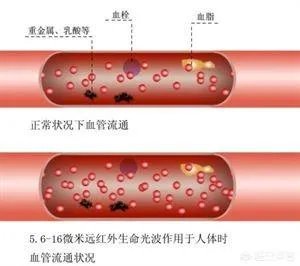 血管堵塞,身体会发出哪些求救信号?吃什么食物可以疏通血管?