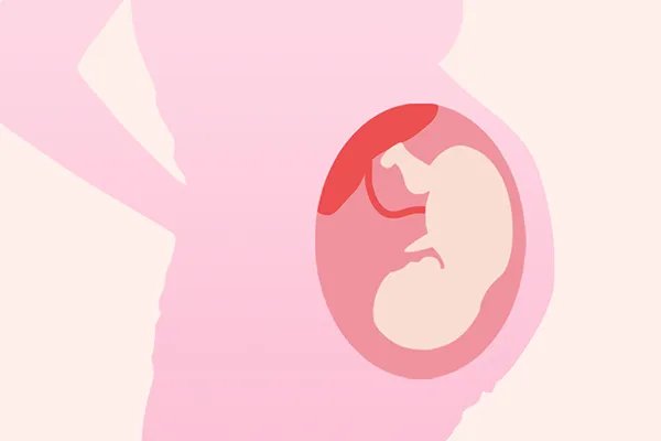 孕妇吸入二手烟有什么影响