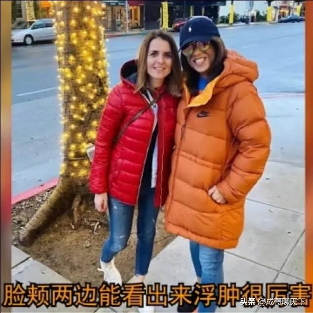 UFC冠军赛后,乔安娜需要进行整形手术而张伟丽却完全不需要,这是为什么?你怎么看?