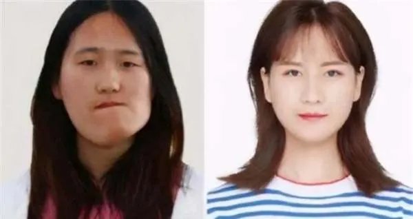 还记得“歪脸女孩”赵宏秋吗？整容变女神，弃百万年薪当老师，你怎么看？