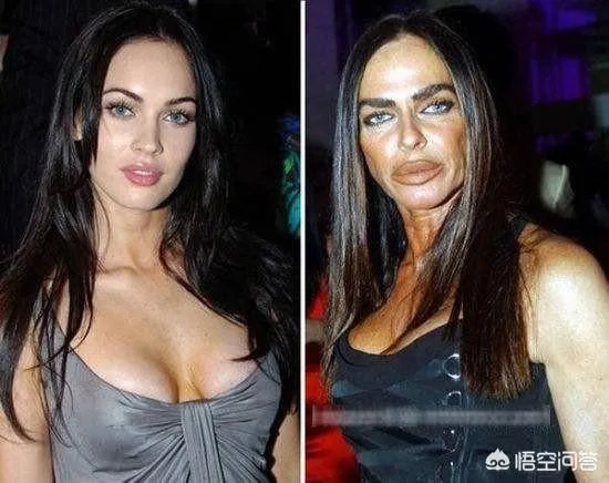 医疗美容(医美)与整形美容的差别是什么?