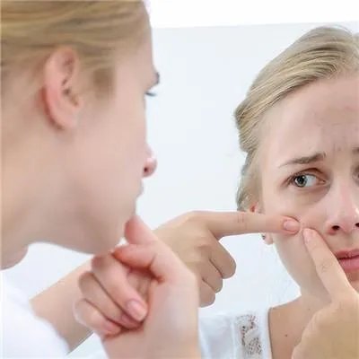 去痘痕最有效的方法