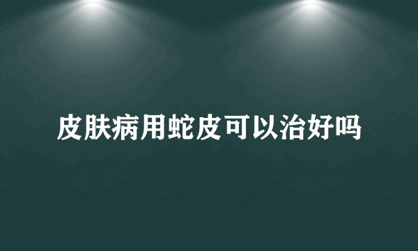 皮肤病用蛇皮可以治好吗