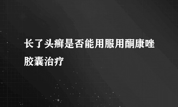 长了头癣是否能用服用酮康唑胶囊治疗