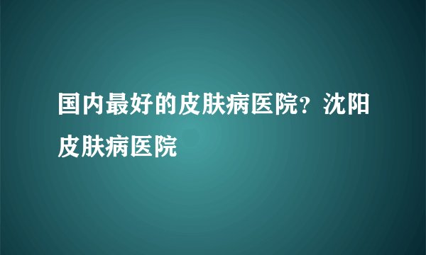 国内最好的皮肤病医院？沈阳皮肤病医院