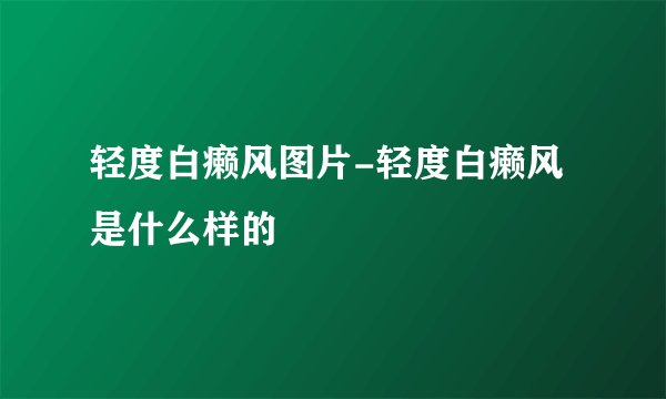 轻度白癞风图片-轻度白癞风是什么样的