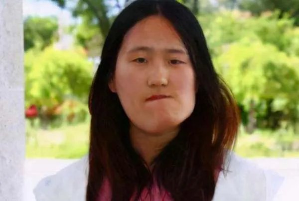 还记得“歪脸女孩”赵宏秋吗？整容变女神，弃百万年薪当老师，你怎么看？
