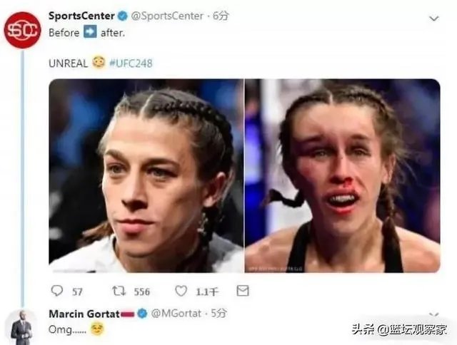 UFC冠军赛后,乔安娜需要进行整形手术而张伟丽却完全不需要,这是为什么?你怎么看?