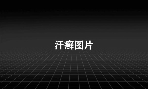 汗癣图片
