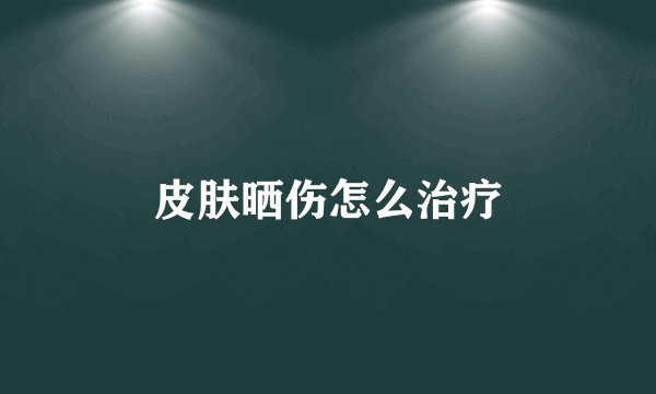 皮肤晒伤怎么治疗