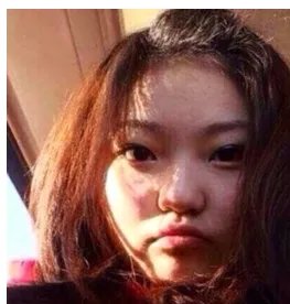 周扬青整容了吗?