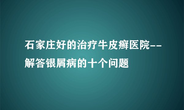 石家庄好的治疗牛皮癣医院--解答银屑病的十个问题