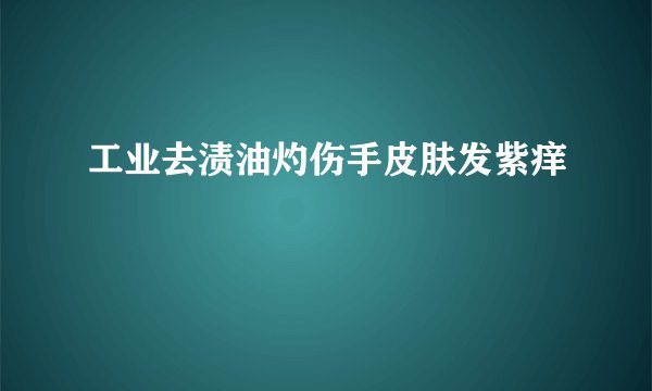 工业去渍油灼伤手皮肤发紫痒