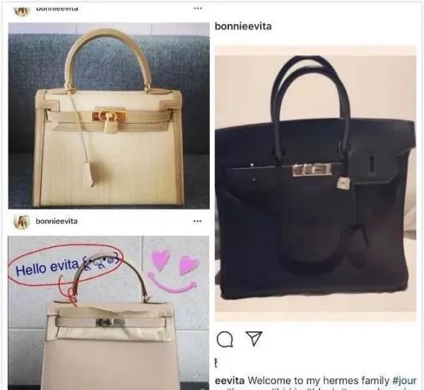 女子微整失败后崩溃，有哪些知名人物是因为整容死亡的？