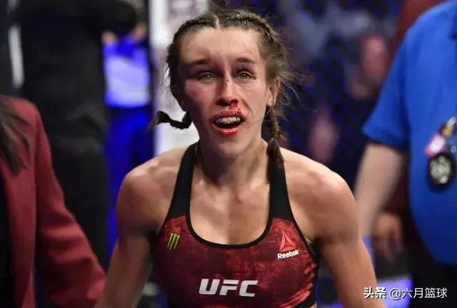 UFC冠军赛后,乔安娜需要进行整形手术而张伟丽却完全不需要,这是为什么?你怎么看?