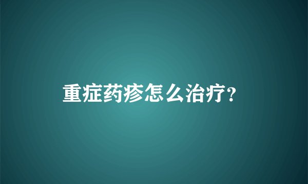 重症药疹怎么治疗？