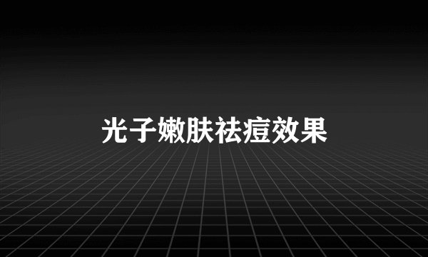 光子嫩肤祛痘效果
