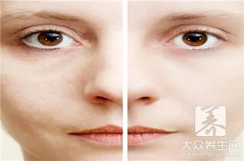 牛奶面膜能去斑吗?