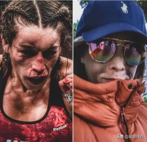 UFC冠军赛后,乔安娜需要进行整形手术而张伟丽却完全不需要,这是为什么?你怎么看?