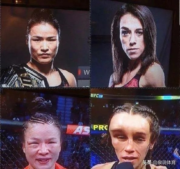 UFC冠军赛后,乔安娜需要进行整形手术而张伟丽却完全不需要,这是为什么?你怎么看?