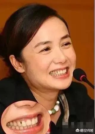 明星们的尴尬瞬间都有哪些?