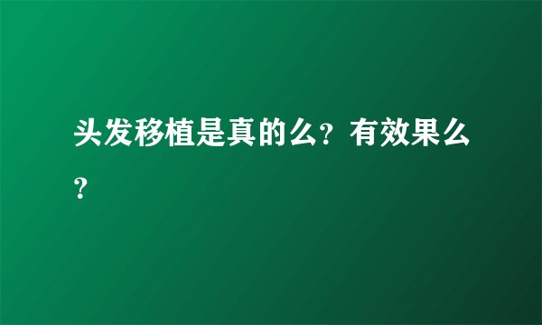 头发移植是真的么？有效果么？