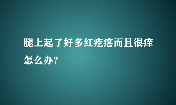 腿上起了好多红疙瘩而且很痒怎么办?