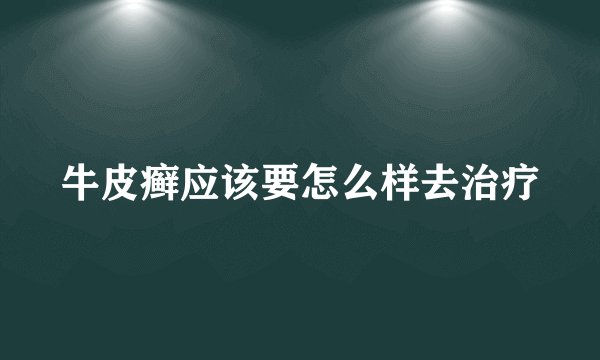 牛皮癣应该要怎么样去治疗
