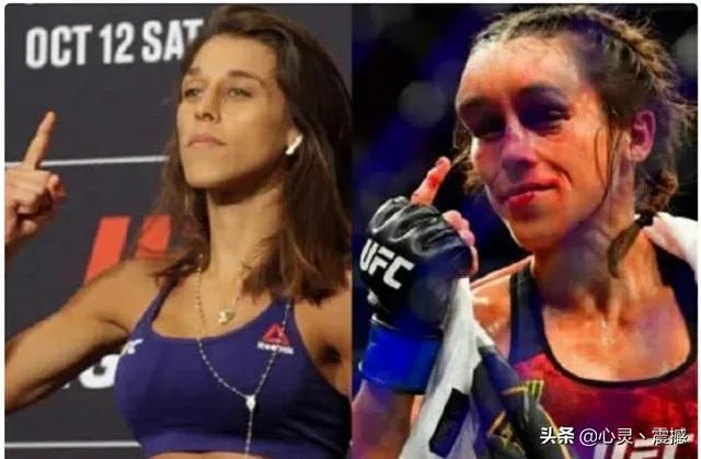UFC冠军赛后,乔安娜需要进行整形手术而张伟丽却完全不需要,这是为什么?你怎么看?